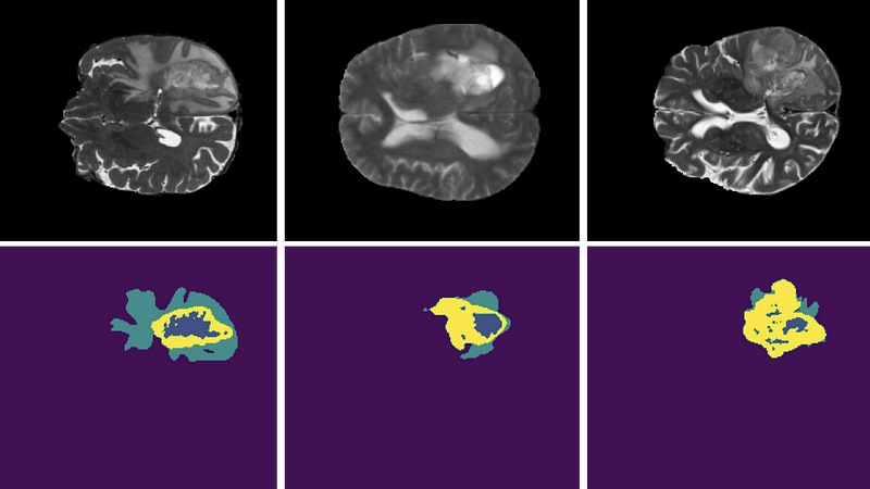 Background Presence in Medical Imaging