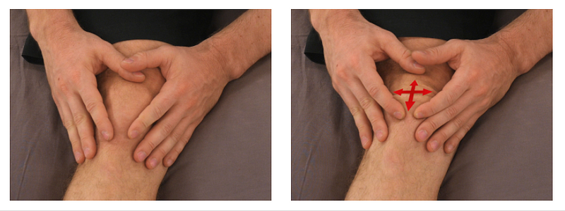 Patellar Mobilization Exercise