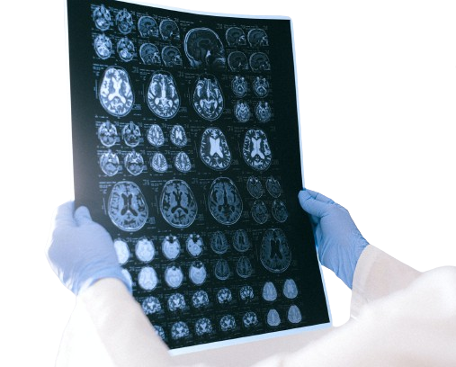 AI analyzing brain imaging scans for early detection