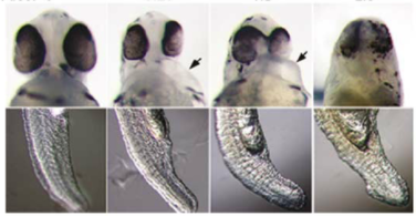 Defects in zebrafish due to alcohol exposure